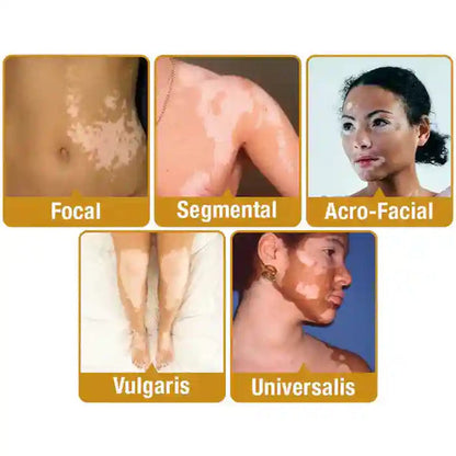 Bee venom cream